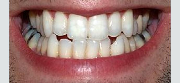 teeth.jpg